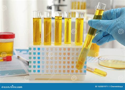 Doctor Holding Test Tube With Urine Sample For Analysis In Laboratory