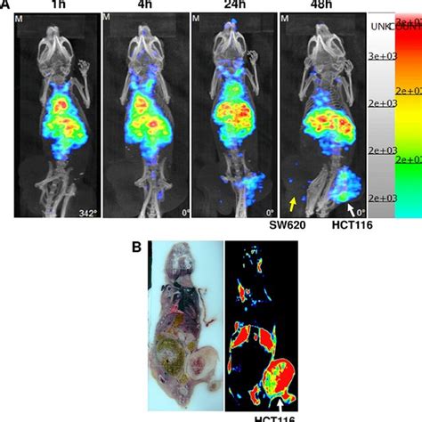 Biodistribution Of 111 In Cetuximab And 111 In DTPA In Metastatic