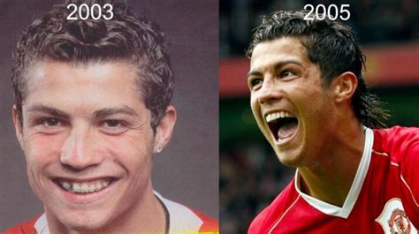 Cristiano Ronaldo Chirurgie Esth Tique L Incroyable Transformation