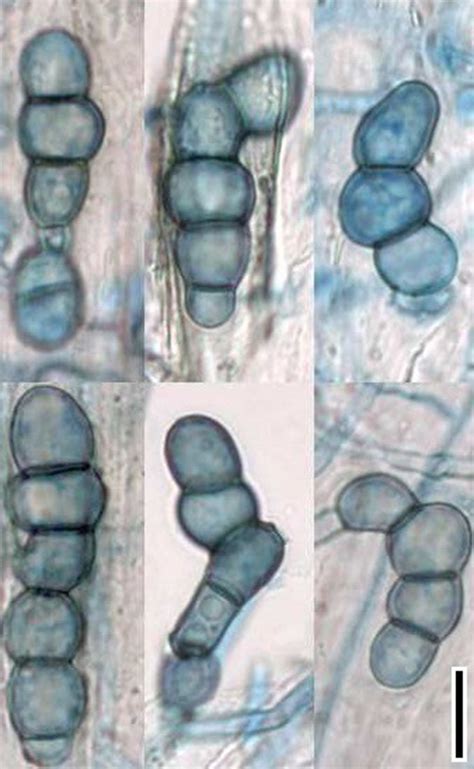 First Report Of Ilyonectria Sp Affecting Foliage Of Tulipa Denton