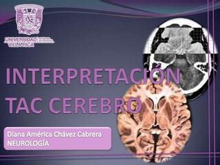 Interpretacion De TAC Cerebro PPT