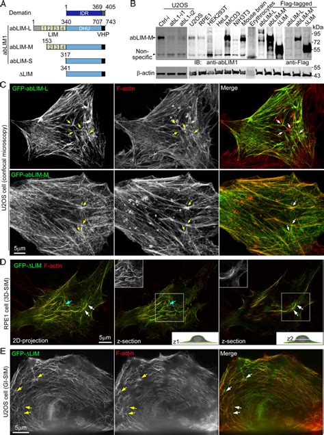 The Ablim1 Isoforms Associate With Subcellular Actin Cytoskeletons