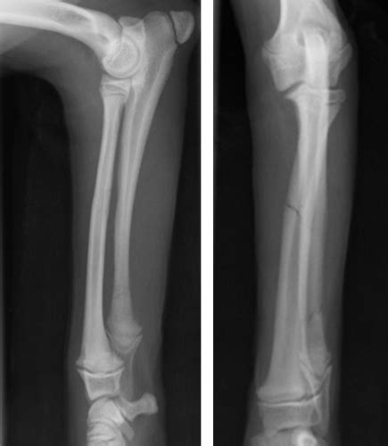 Ortho Imaging Lameness Flashcards Quizlet