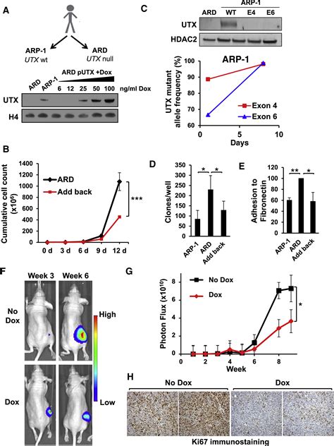 Utxkdm6a Loss Enhances The Malignant Phenotype Of Multiple Myeloma And