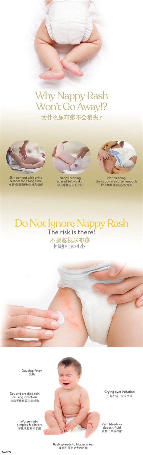 Babe Nappy Rash Cream Relief Nappy Discomfort Alpro Pharmacy