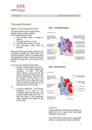 Tricuspid Atresia PDF