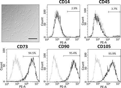 Phenotypic Characterisation Of Human Adipose Derived Mesenchymal