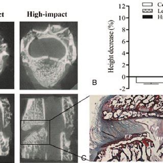 Representative Micro CT Analysis For Each Group And The Histological