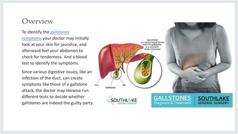 PPT Gallstone Diagnosis And Treatment At Southlake General Surgery