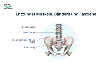 Bungen Um Eine Isg Blockade Zu L Sen Und Schmerzen Zu Lindern