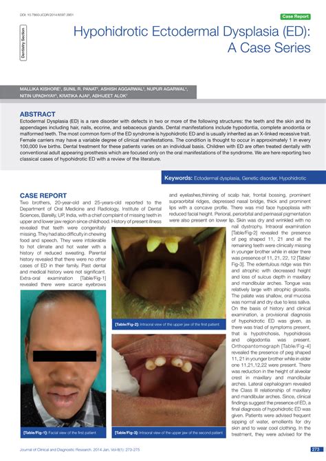 Hypohidrotic Ectodermal Dysplasia (ED): a Case Series Dentistry Section - DocsLib