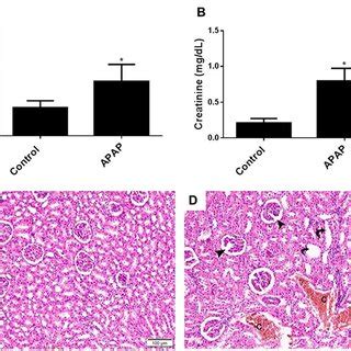 Quercetin Protects Against Apap Induced Modulation Of Biomarkers Of