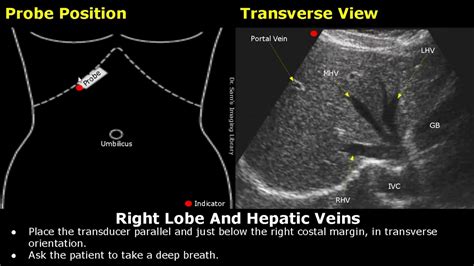 Liver Ultrasound Probe Positioning Transducer Placement For Liver