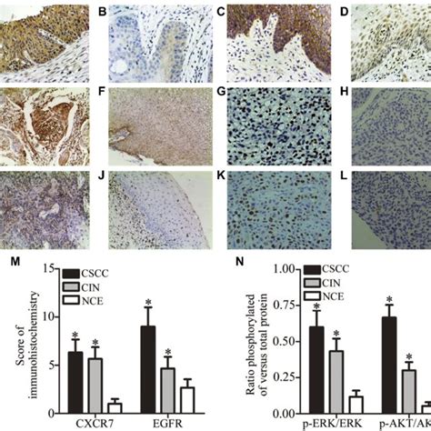 Immunohistochemical CXCR7 And EGFR Staining Of Tissue Samples Of CSCC