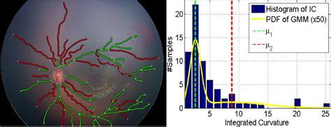 Computer Based Image Analysis For Plus Disease Diagnosis In Retinopathy