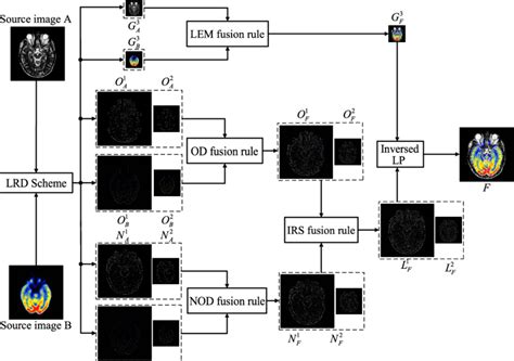 Principle Diagram Of Multimodal Medical Image Fusion Method By Lrd