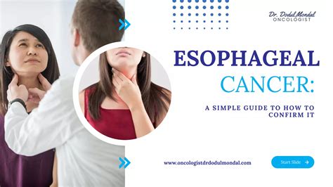 How To Confirm Esophageal Cancer A Simple Guide PPT