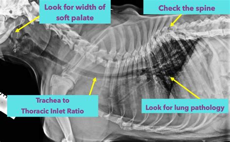 Corrective Airway Surgery Dr Melissa Kozaruk