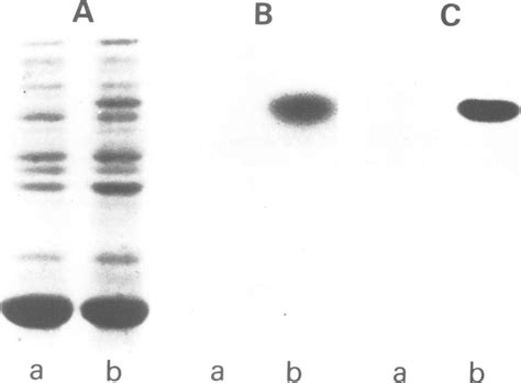 Sds Polyacrylamide Gel Electrophoresis Protein Patterns And Gel Download Scientific Diagram