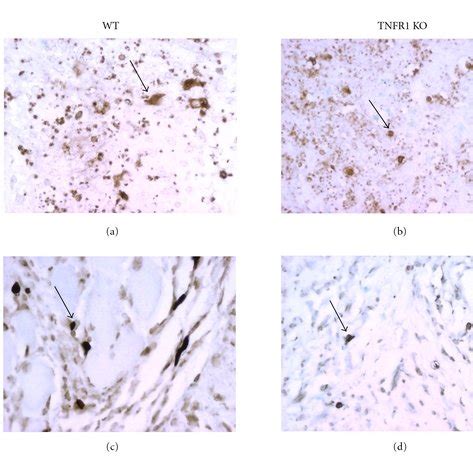 Apoptosis In Lesions From Wt And Tnfr Ko Mice Infected By L Major