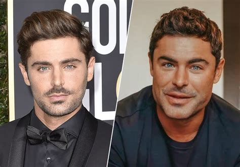 Chirurgie Esthétique Zac Efron Dévoile Enfin La Vraie Raison De Sa