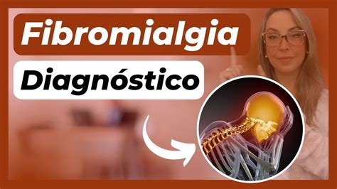 COMO É FEITO O DIAGNÓSTICO DA FIBROMIALGIA QUE EXAME DETECTA YouTube