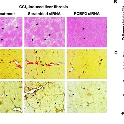 Histological Analysis Of Liver Specimen A H E Picro Sirius Red And