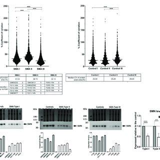 Variability in protein expression and levels of SMN protein in SMA ...