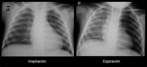 Continuum Radiograf A De T Rax Indicaciones Diagn Stico Y Casos