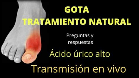 Gota En El Pie Descubre El Tratamiento Natural En Solo 5 Pasos