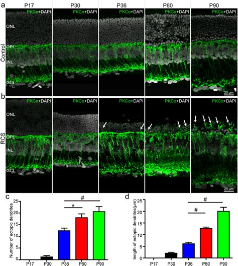 The Morphological Changes Of Rbcs During Retinal Degeneration In Rcs