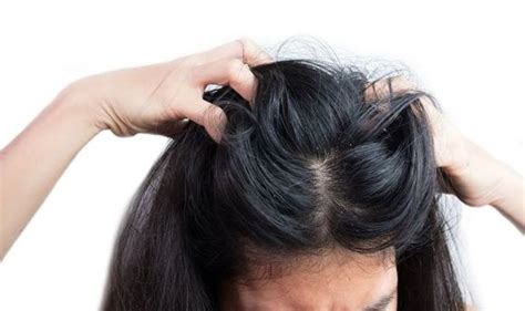 Does Dandruff Cause Hair Loss The Truths And Treatment Myths Behind