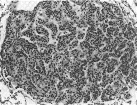 Figure 3 From Morphology Of Neoplastic Lesions Induced By 13 Butadiene In B6c3f1 Mice