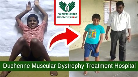 Duchenne Muscular Dystrophy New Treatment In India Dmd Treatment In