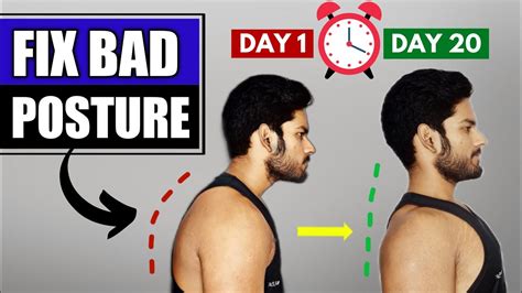 Only 4 Exercises To Fix Your Bad Posture Posture Correction Exercises