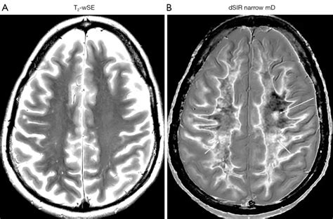 Leading revolution in MRI contrast weighting – Mātai Medical Research Institute