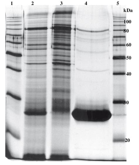 Sdspage Under Reducing Conditions Of Crude Whole Bovicola Ovis Antigen