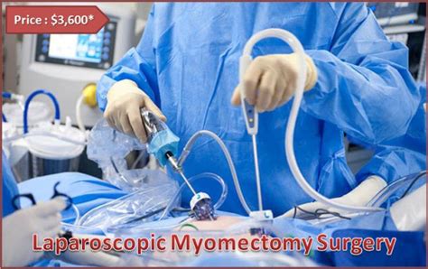 Minimally Invasive Myomectomy Surgery In India Fibroid Surgery