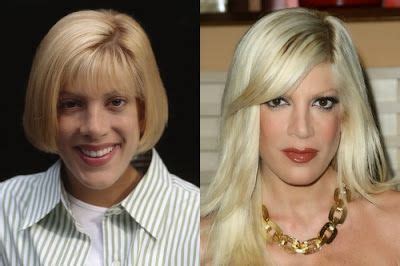 Tori Spelling With Images Celebrity Plastic Surgery Nose Job