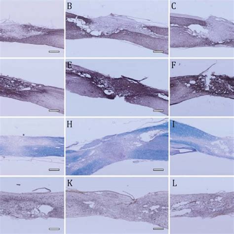 Immunohistochemistry Gfap Cspg Eriochrome Cyanine Iba 1 A I