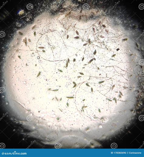 Alternaria Fungal Spores Under The Microscope Stock Image ...