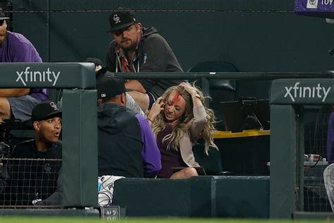 Mlb Reporter Kelsey Wingert Shows Off Gruesome Injury After Being Hit