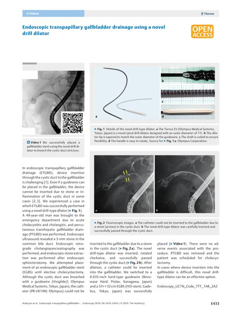 Pdf Endoscopic Transpapillary Gallbladder Drainage Using A Novel