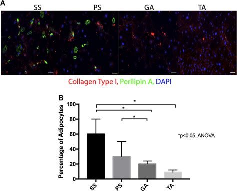 A Representative Images Of Fibro Adipogenic Progenitors Faps