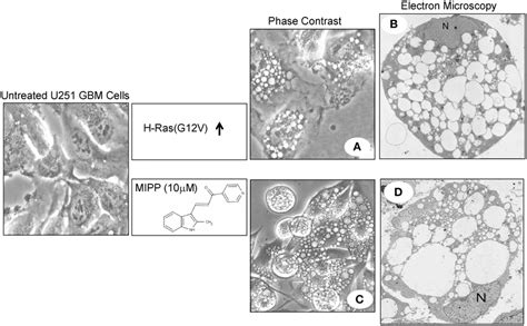 Examples Of Extreme Vacuolization Of Macropinosomes Associated With