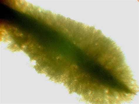 Freshwater Sponge Gemmule Under The Microscope Quekett Microscopical Club