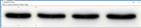 蛋白质免疫印迹western Blot，wb 怎么应用 Imagej 测量 Western Blot（wb）条带灰度值？ 丁香实验