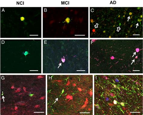 AC Immunofluorescence Merged Images Showing Dual Labeled Rac1b Red