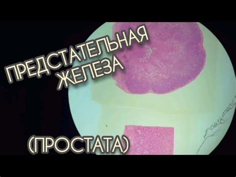 ПРЕДСТАТЕЛЬНАЯ ЖЕЛЕЗА или ПРОСТАТА - YouTube