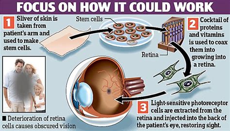 Eye Grown From Stem Cells Scientists Grow Retina In Lab Bringing